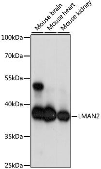 LMAN2 antibody