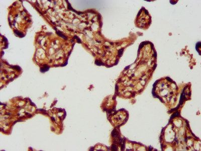 LMCD1 Antibody