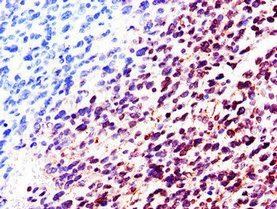 LMNB2 Antibody