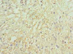 LMOD1 Antibody