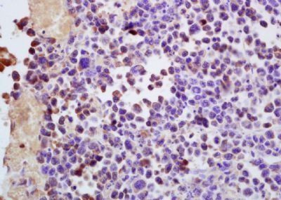 EBV LMP2A Rabbit Polyclonal Antibody
