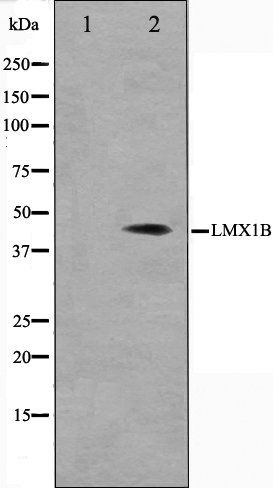 LMX1B antibody