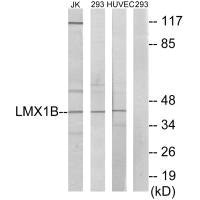 LMX1B antibody