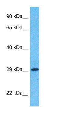 LN28B antibody
