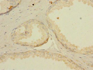 LNX2 Antibody