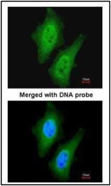 serine/threonine kinase like domain containing 1 Antibody