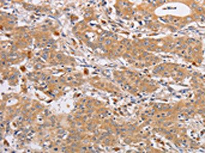 LOX-1 antibody