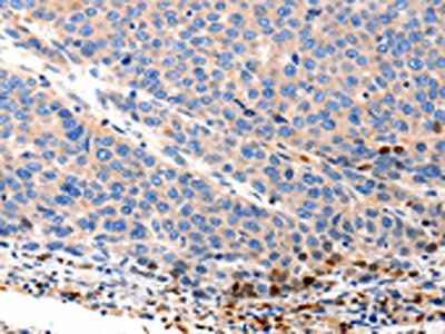 OLR1 Antibody