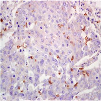 LOX-1 antibody