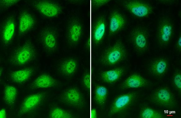 lysyl oxidase like 2 Antibody