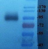 LOXL2 antibody