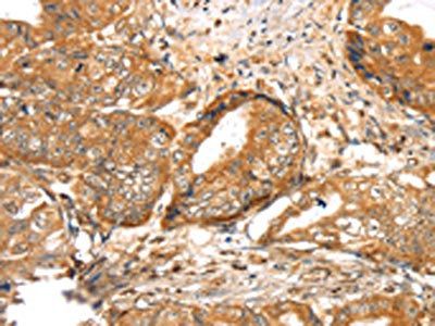 LOXL4 Antibody