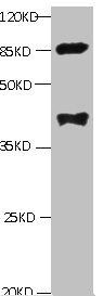 PLA2G7 Monoclonal Antibody