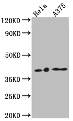 LPAR1 Recombinant Monoclonal Antibody