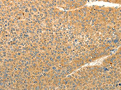 LPAR3 Antibody