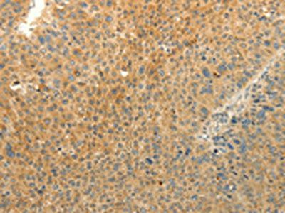 LPAR3 Antibody
