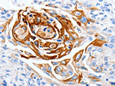 LPAR4 Antibody