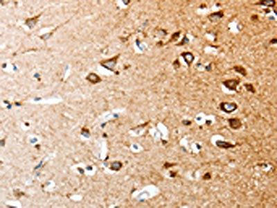 LPAR4 Antibody