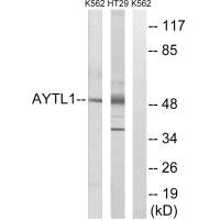 LPCAT2 antibody