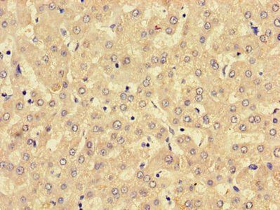 LPCAT3 Antibody
