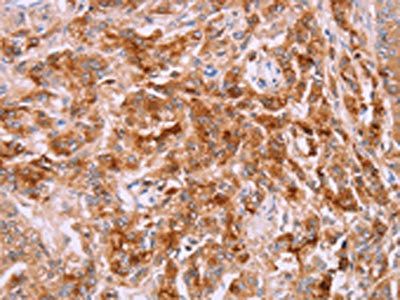 LPCAT4 Antibody