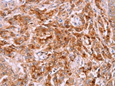 LPCAT4 antibody