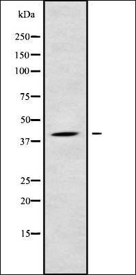 LPGAT1 antibody