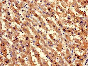 LPGAT1 Antibody