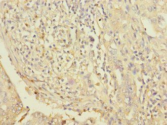 LPIN1 Antibody