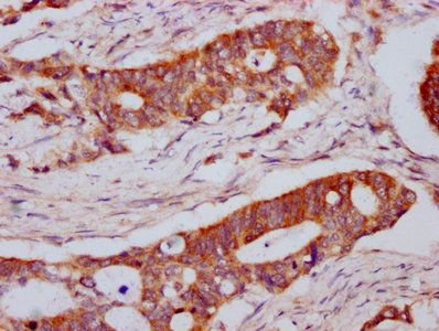 LPL Antibody
