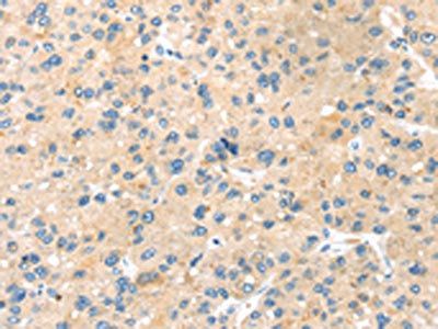 LPP Antibody