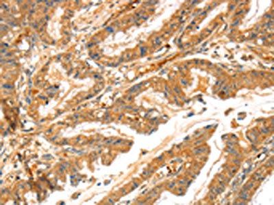 LPP Antibody