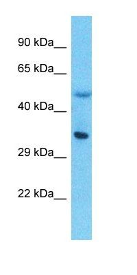 LPPR5 antibody