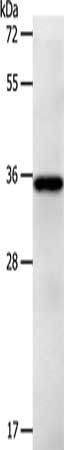 LPPR5 antibody