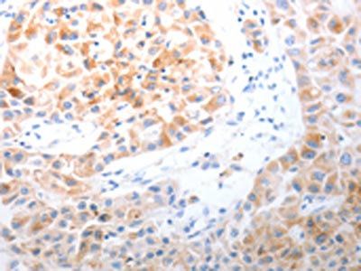 LPPR5 Antibody