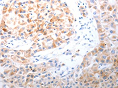 LPPR5 antibody