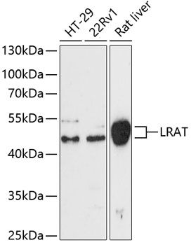 LRAT antibody