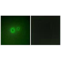 LRAT Antibody