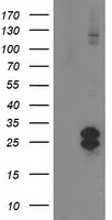 LRATD2 antibody