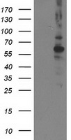 LRATD2 antibody