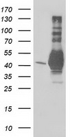 LRATD2 antibody