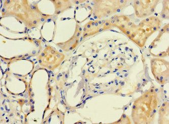 LRCH1 Antibody