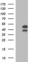 LRCH4 Antibody