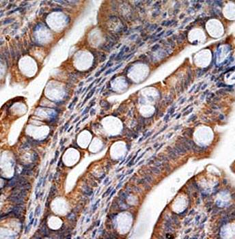 LRCH4 Rabbit Polyclonal Antibody