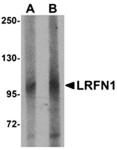 LRFN1 Antibody