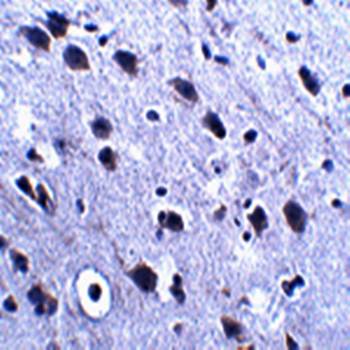 LRFN2 Antibody