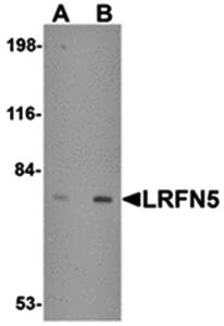LRFN5 Antibody