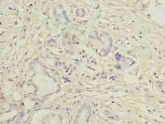 LRG1 antibody