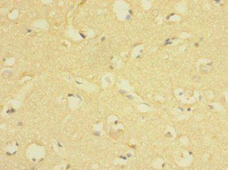 LRIG1 Antibody