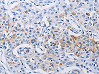 LRIG1 antibody